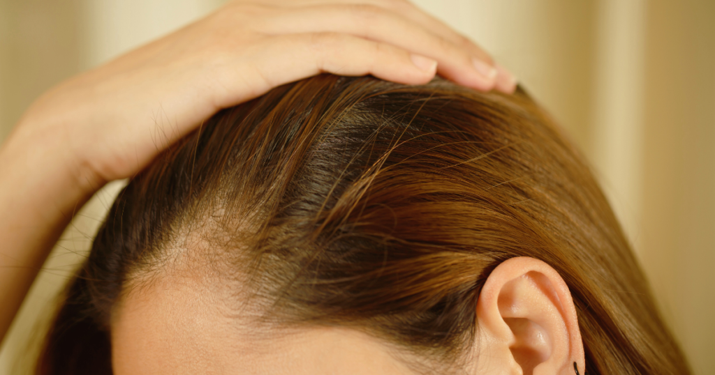 40代50代女性の頭皮のかゆい原因と乾燥対策を解説する頭皮ケアイメージ